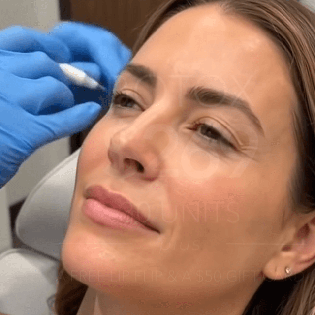 Botox Deposit $25 at Alchemy Aesthetics + MedSpa in Overland Park, KS